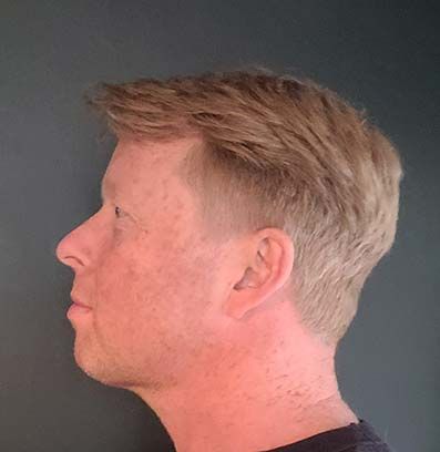 Picture of Patrick's face - side profile trying desperately to restrain double chin.